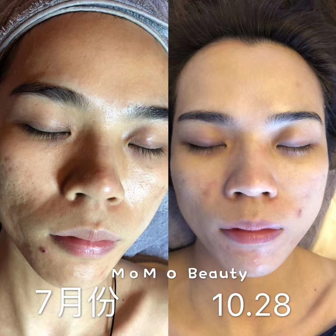 东莞哪里有护肤品齐全的地方,东莞美容护肤哪里好