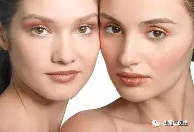 果酸换肤效果如何,果酸换肤的原理