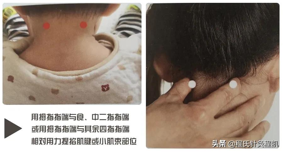 儿童感冒吃什么药不发热,儿童感冒初期用什么偏方比较好