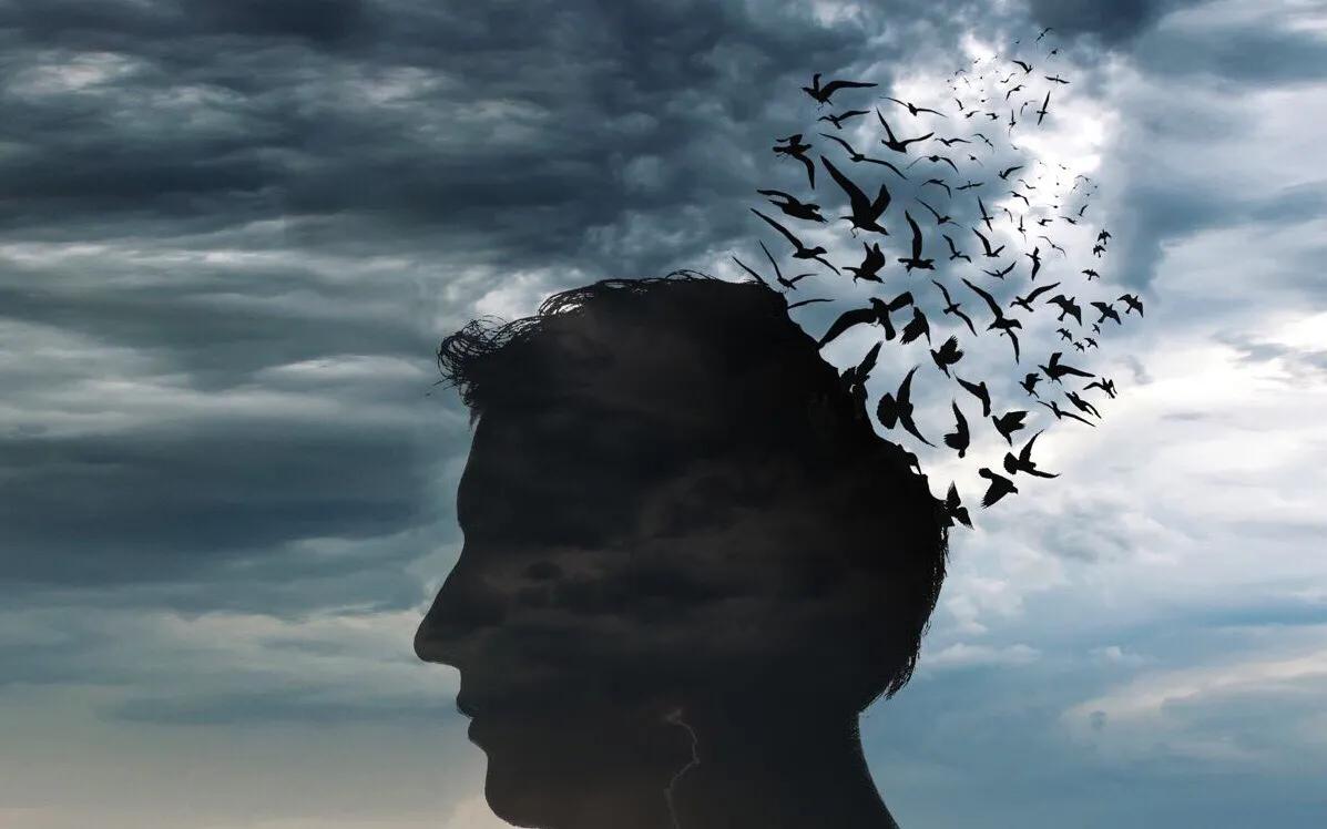 地中海m字额头男生发型,地中海M型发际线