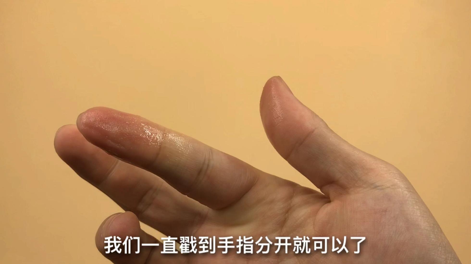 502胶水粘到手指硬化怎么清除,502胶弄到手上手指麻是怎么回事