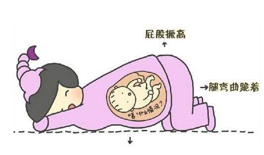 胎儿臀位大必须剖腹产吗,胎儿臀位该如何选择分娩方式