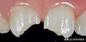 冰雪天气，专家支招应对5类口腔疾病