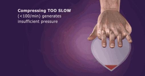 cpr心肺复苏术胸外按压和人工呼吸,心肺复苏术操作步骤有cpr吗