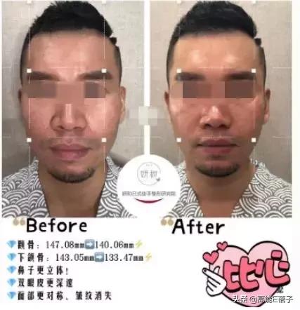 脸大真的不如脸小的好看吗,脸小真的显瘦吗