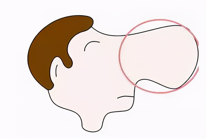 男子喝40年的酒鼻子长到下巴,男子喝了四十年的酒