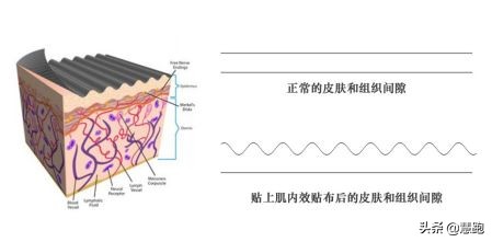 运动是最好的防护措施,跑步运动防护小知识大全