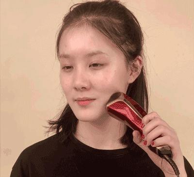 做了微整之后的感悟,微整经验