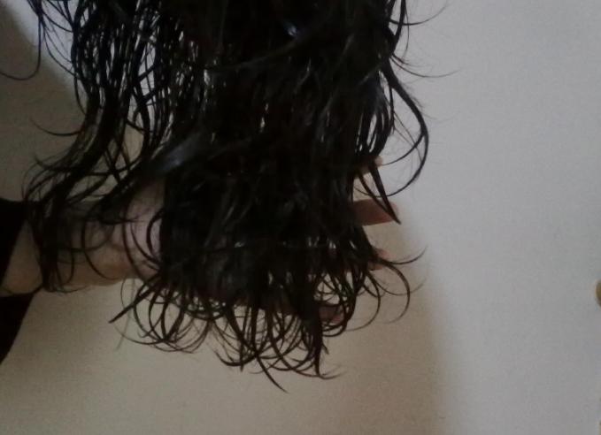 头皮长了个疙瘩破了怎么办,头皮为啥老长粉刺之类的疙瘩