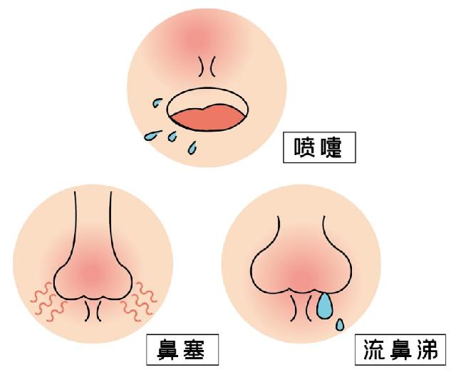 北京医院儿童鼻炎用什么药,北京哪个医院儿童鼻炎看得好
