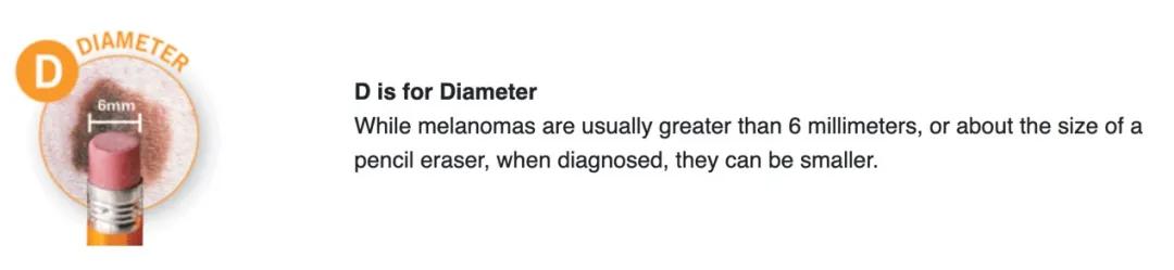 宝宝刚长出来的痣怎么消除,婴儿先天的痣容易癌变