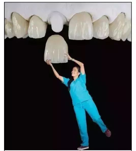 全瓷牙冠在保质期可以免费重做吗,全瓷牙冠价格表2021款报价