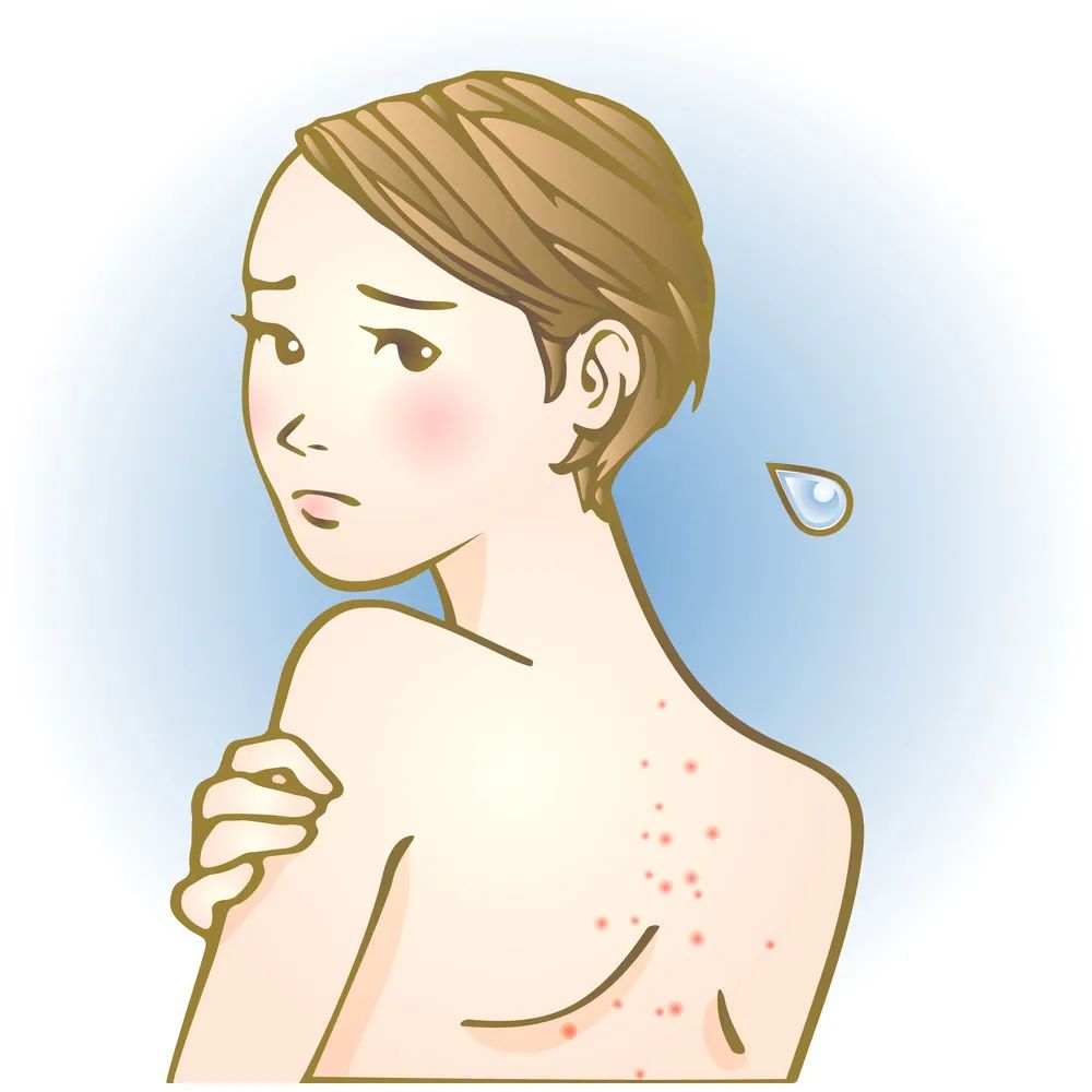 脸旁边及以下长痘痘怎么办,除脸以外的地方长了痘痘怎么办