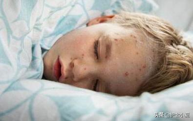 水痘高发期，孩子得了水痘怎么办？宝妈们该如何防“痘”