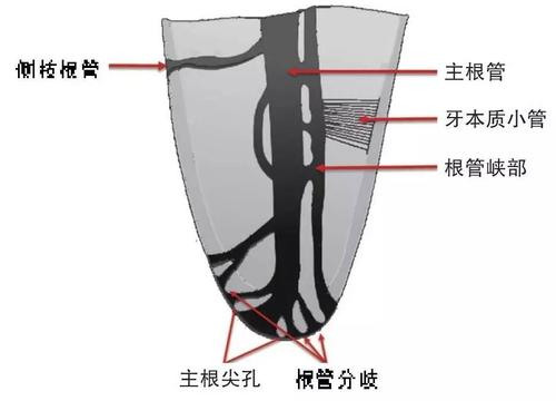 根管治疗没问题为什么牙还是难受,根管治疗为什么5年后根管会发炎