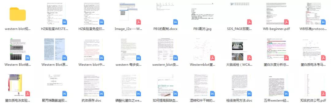 westernblot资源大全，基础实验中最基本的WB应该是必须知道哒