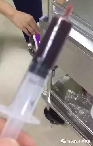 哈尔滨市儿童医院多学科团队齐心救治4岁男孩肝破裂Ⅴ级严重外伤