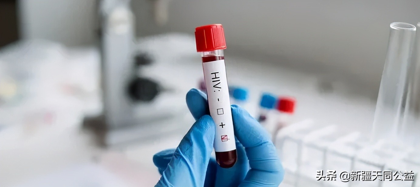 碰到艾滋病患者的血会被传染吗,碰到艾滋病血液会被传染吗