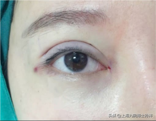 上海九院孙沣博士,孙沣案例