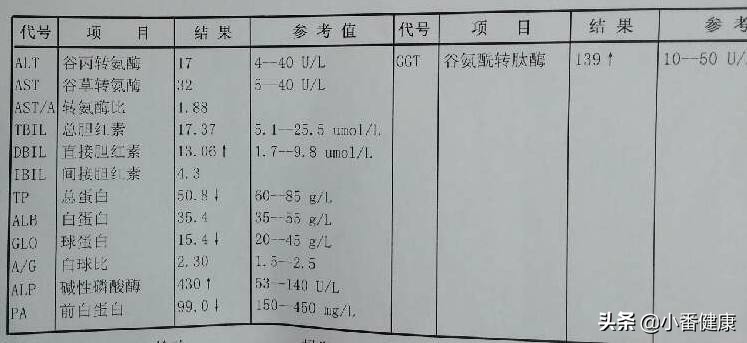慢性乙肝出现黄疸,慢性乙肝出现黄疸升高严重吗
