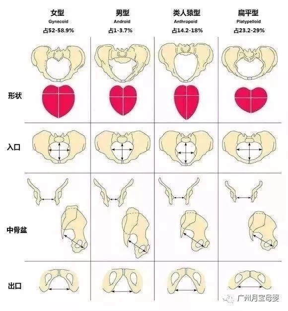 屁股大的女生好生养,屁股大的女人适合生孩子吗
