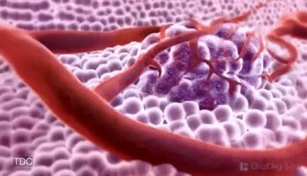 有治疗甲状腺癌特效药吗,治疗甲状腺癌最好中医