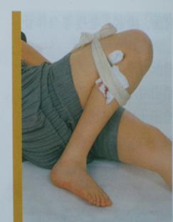 创伤现场救治的目的,创伤的现场急救视频