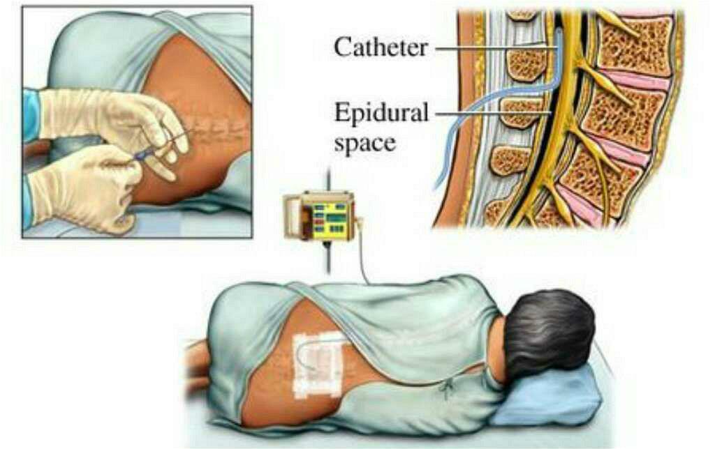 为什么有些女性生娃时没那么痛?可能是基因变异在“帮忙”