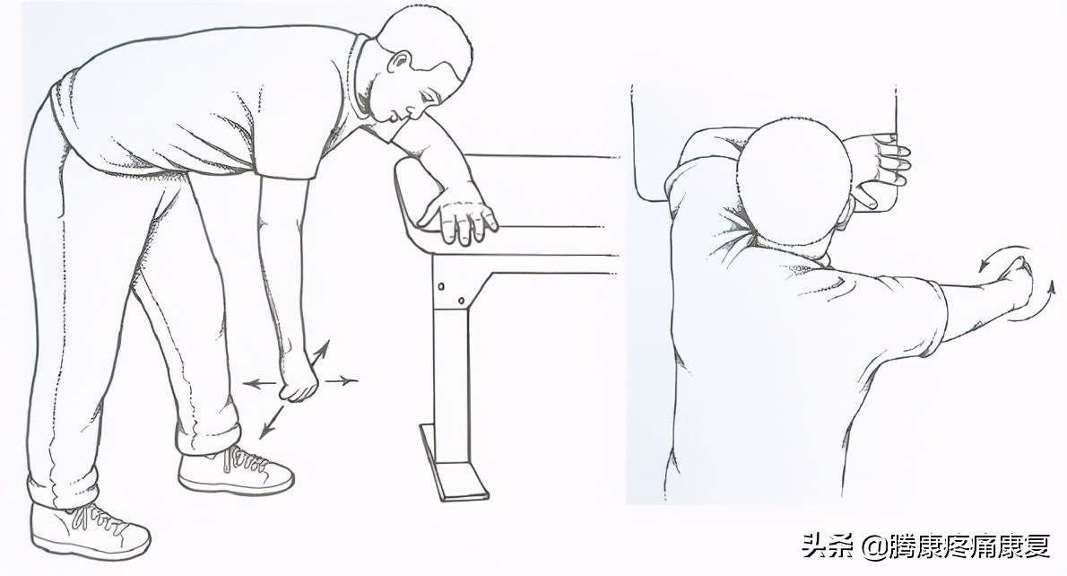 肩关节急性钙化性肌腱炎