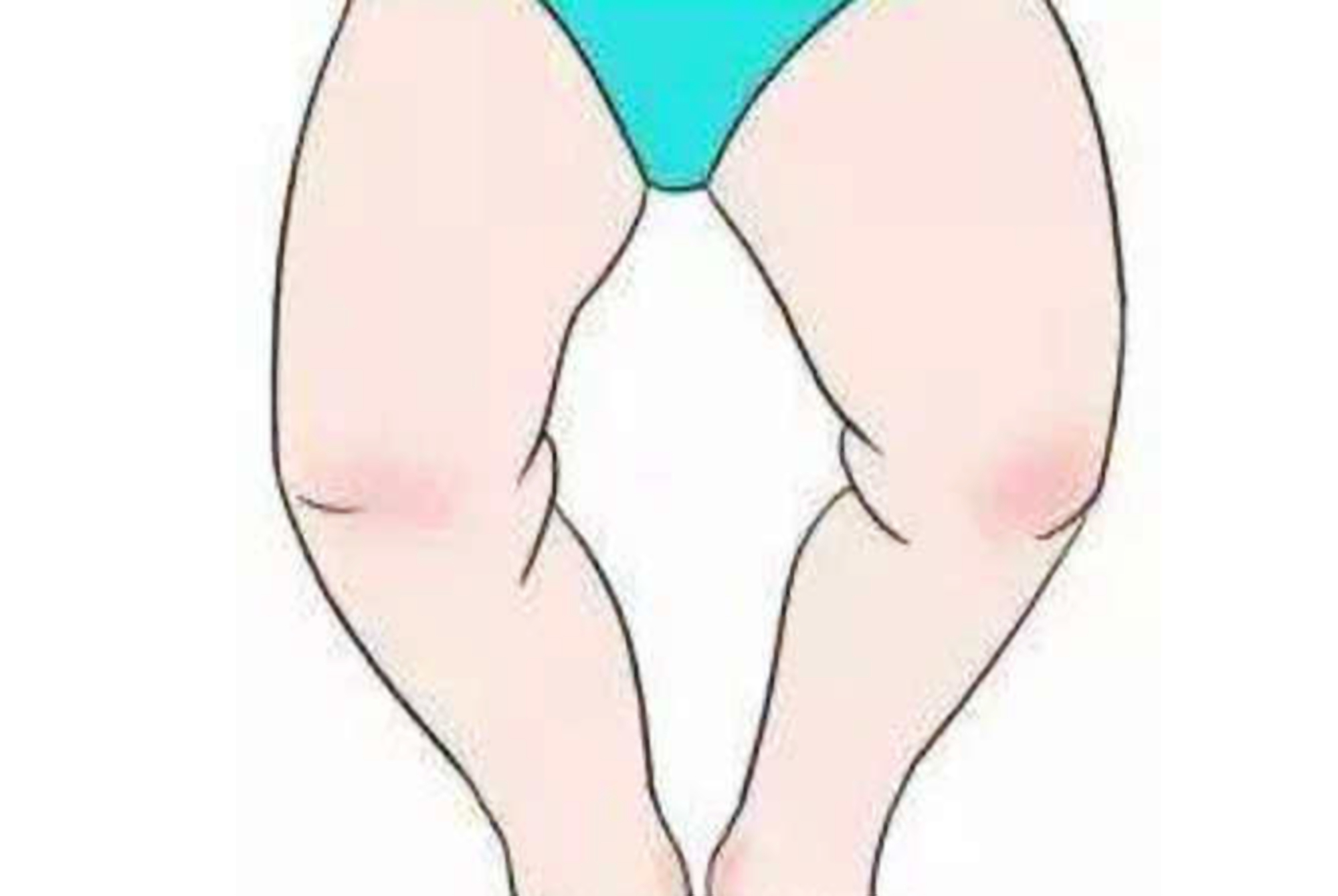 为什么中国孩子容易“罗圈腿”?多半是和父母的这3种习惯有关