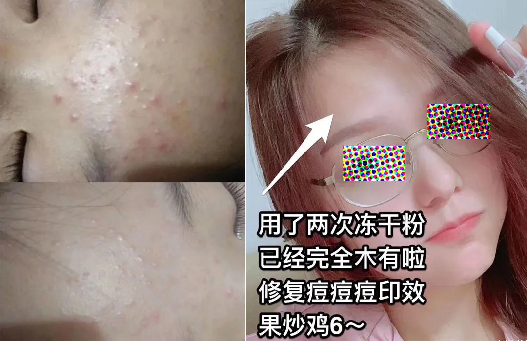 「好评反馈来啦」疯狂打call，实力表白｜为什么*干粉冻**这么受欢迎