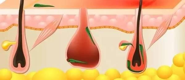 犬常见皮肤病,犬蠕形螨怎么治疗