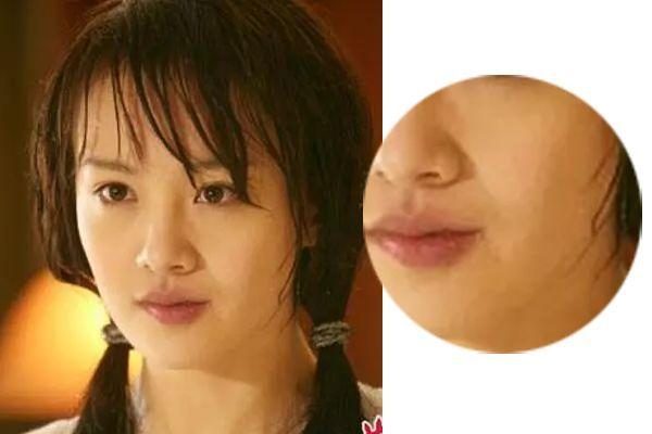 法令纹去皱纹最好的方法,法令纹去皱纹最有效的方法