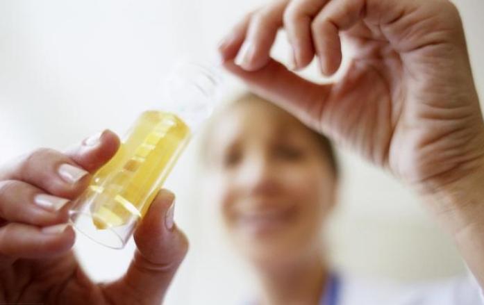 尿痛要留神这8种病尿液里暗藏的那些健康密码,必知