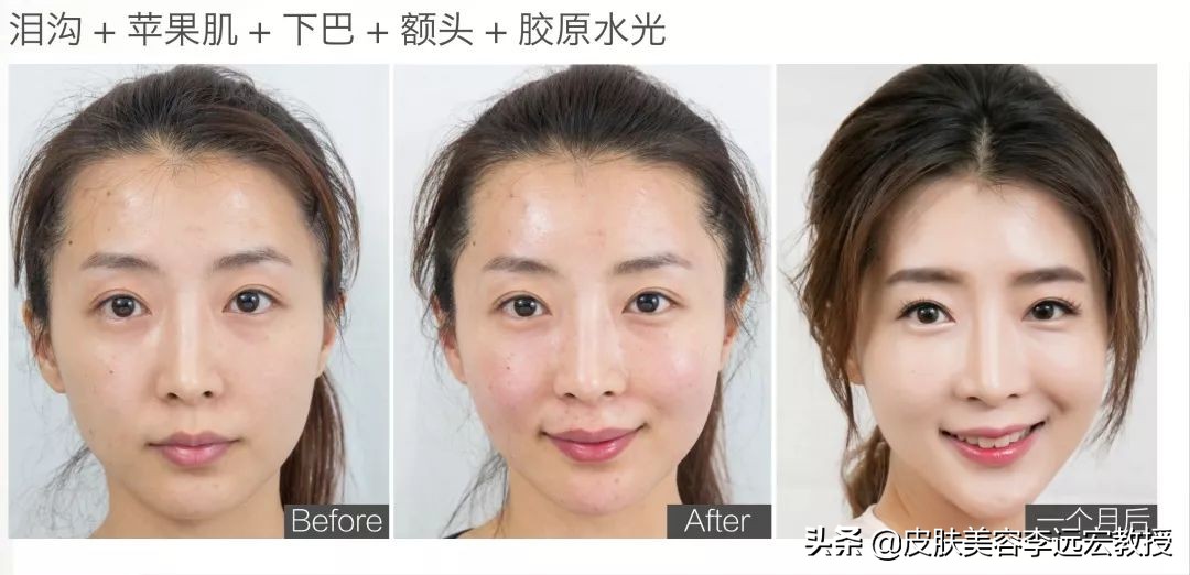 哪种口服胶原蛋白效果好,口服胶原蛋白的骗局