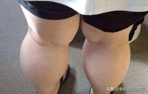 提踵怎么既练习弹跳又瘦小腿,如何瘦小腿的运动方法