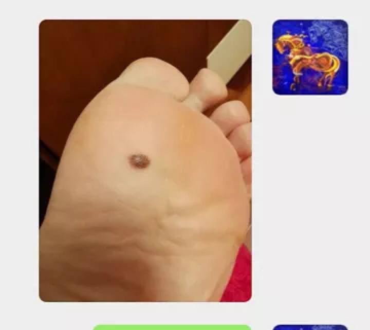 哪些部位长痣预示一生劳碌,痣的位置预示着什么