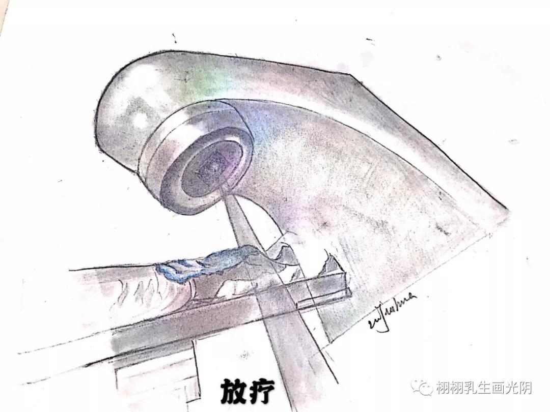 乳腺癌的照妖镜钼靶检查,乳腺癌的照妖镜检查