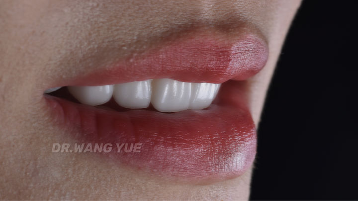 上海舌侧正畸医生,上海舌侧矫正哪家好