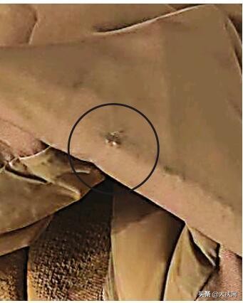 网购羽绒服的破损照片,买回来的羽绒服口袋破损