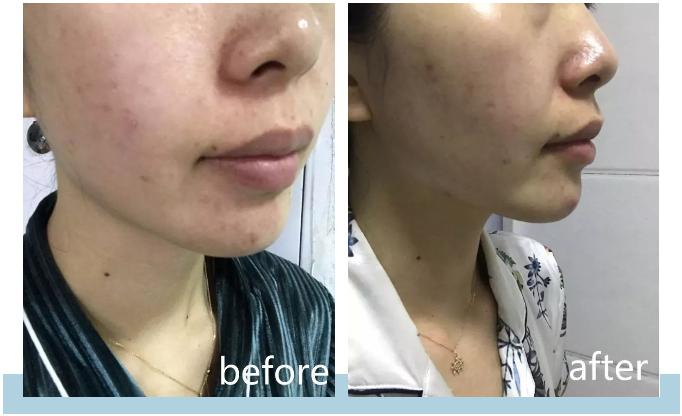 紫檀如何帮助人体抗衰老,紫檀能淡斑吗