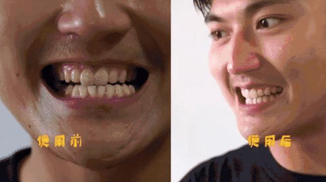 洗牙遭罪不,洗牙难受怎么办