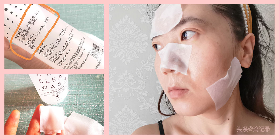 为什么总有螨虫而长痘痘?洗脸顺序、涂抹方式的小技巧