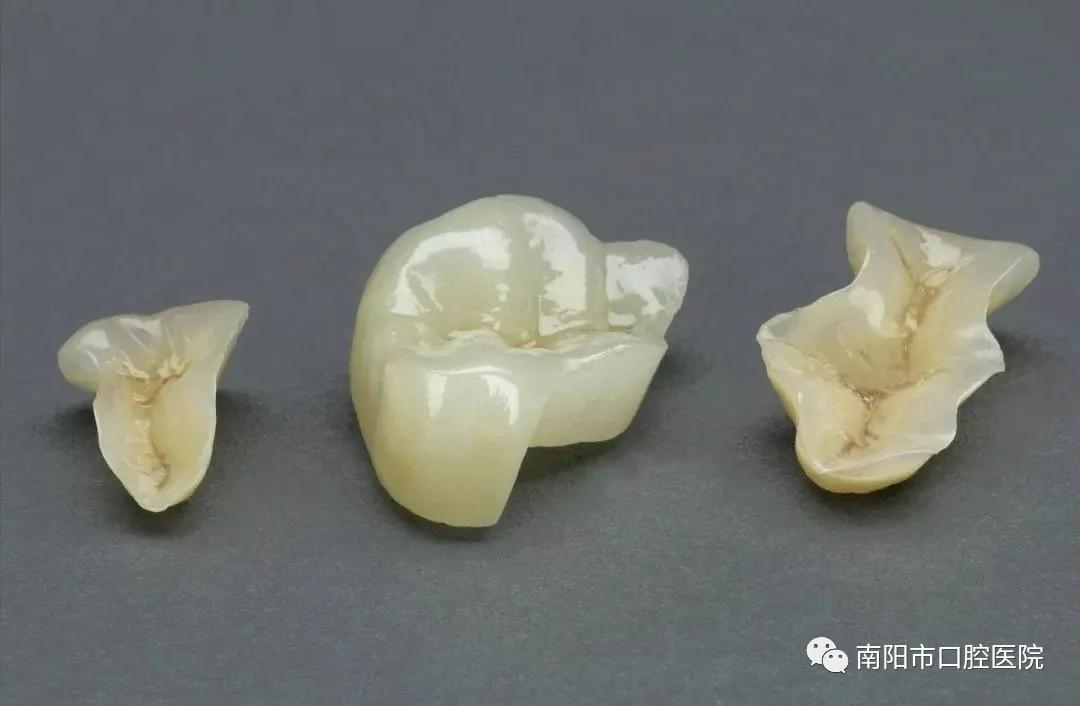 牙齿大面积龋坏牙冠都没了还疼,龋病牙体缺损的手术治疗