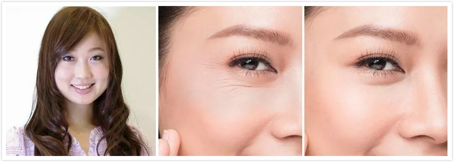 梦禾精华套盒,梦禾效果怎么样