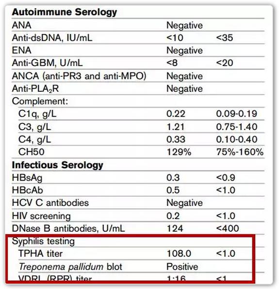 大量尿蛋白9克打单抗管用吗,尿蛋白9克多严重吗