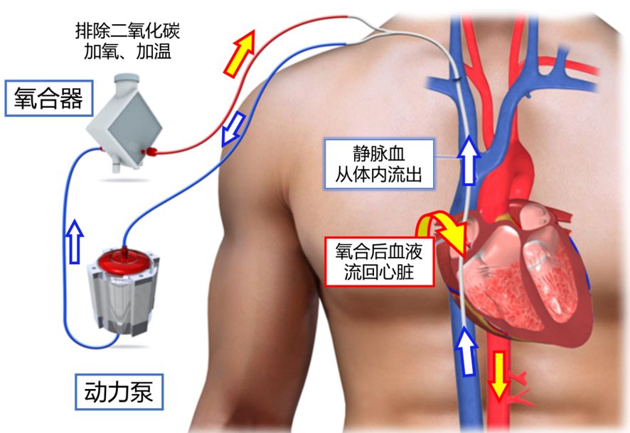 感染病毒,死于窒息:肺里究竟发生了什么?