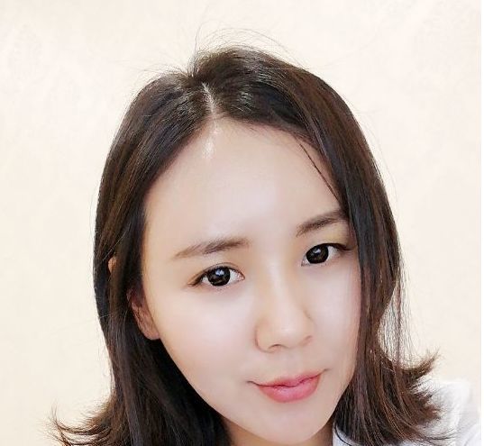 额头扁平怎么填充自然好看,额头颞部怎么填充好看