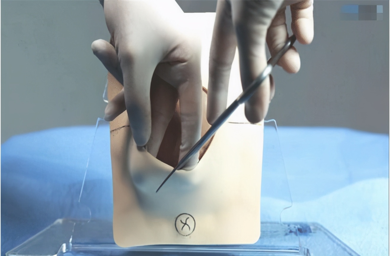 顺产疼还是剖腹疼亲身经历,顺产真的很痛会让人崩溃