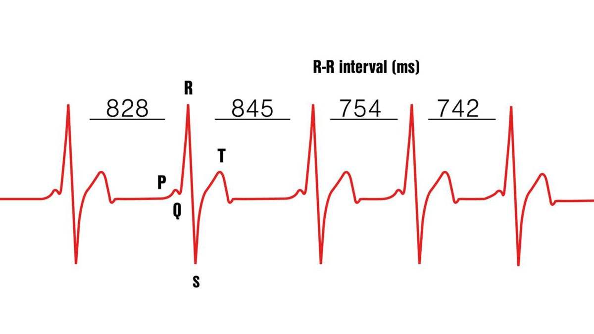 孩子心率变异度训练,心率区间对应训练效果